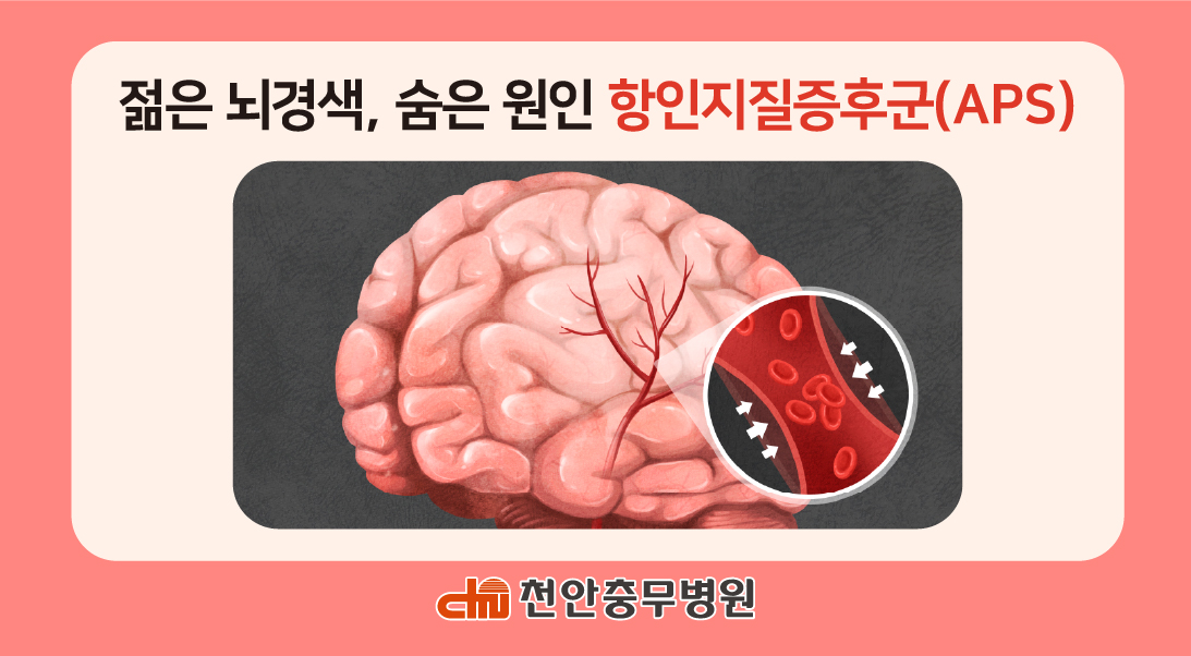 [전문의 칼럼] 젊은 뇌경색, 숨은 원인 ‘항인지질증후군(APS)’